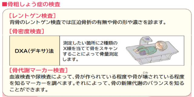 骨粗鬆症