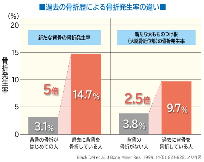 骨粗鬆症